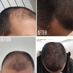 Естетичната медицина не е само за жени